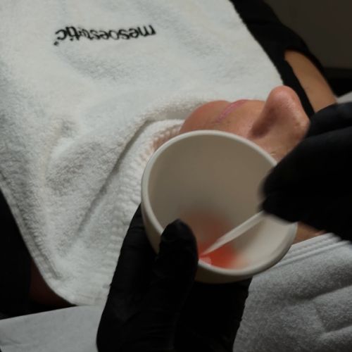 Soins traitants de la peau - Institut de beauté à Grésy sur Aix