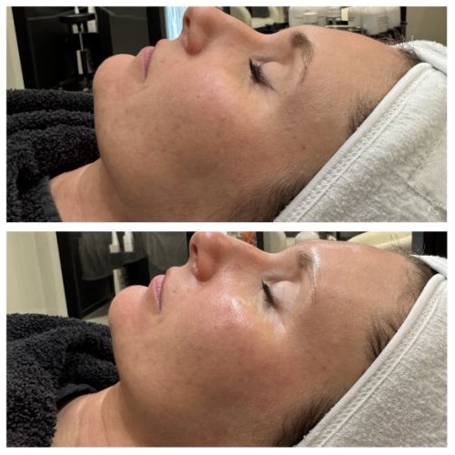 Soins traitants de la peau - Institut de beauté à Grésy sur Aix