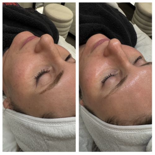 Soins traitants de la peau - Institut de beauté à Grésy sur Aix