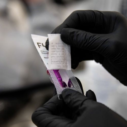 Tricopigmentation à Grésy sur Aix ODB Concept