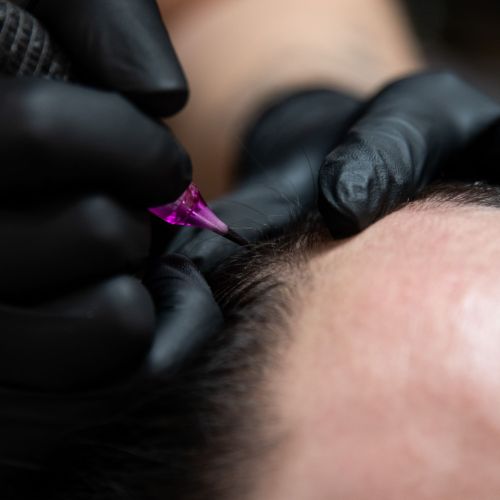 Tricopigmentation à Grésy sur Aix ODB Concept