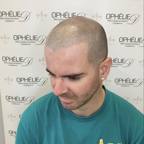 Tricopigmentation à Grésy sur Aix ODB Concept