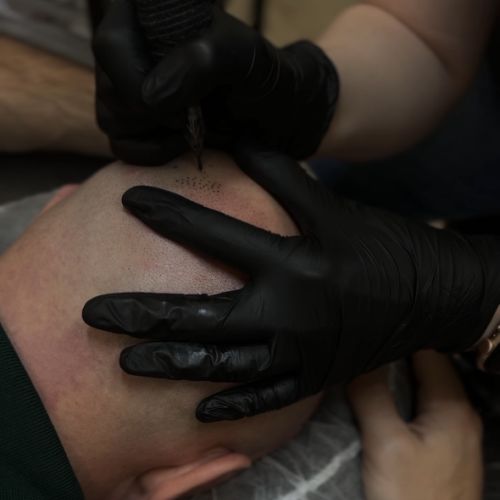 Tricopigmentation à Grésy sur Aix ODB Concept