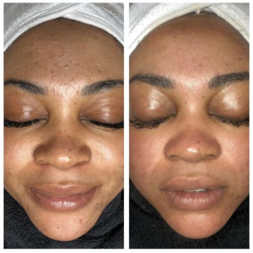 Soins nettoyants de la peau institut de beauté à Grésy sur Aix