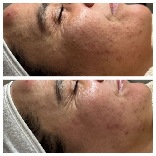 Soins nettoyants de la peau institut de beauté à Grésy sur Aix
