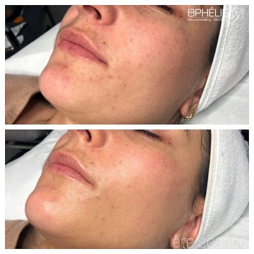 Soins traitants de la peau - Institut de beauté à Grésy sur Aix