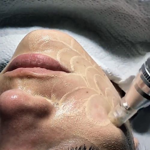 Soins traitants de la peau - Institut de beauté à Grésy sur Aix