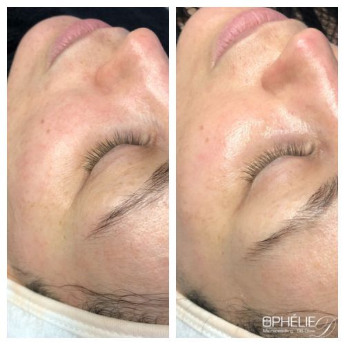 Soins traitants de la peau - Institut de beauté à Grésy sur Aix