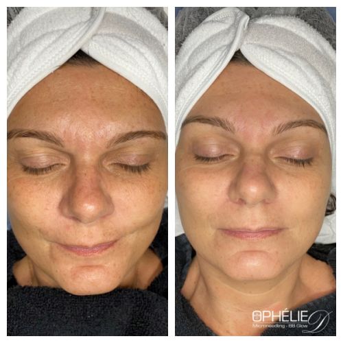 Soins traitants de la peau - Institut de beauté à Grésy sur Aix