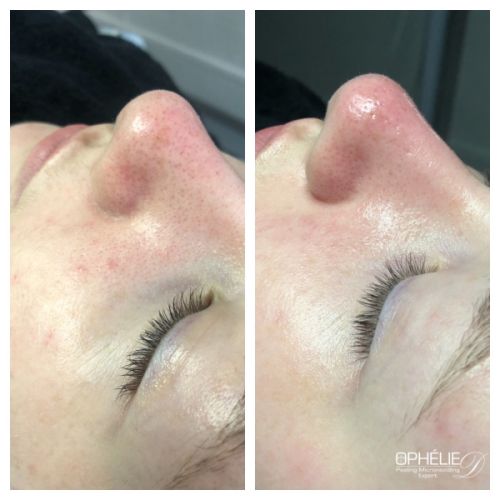 Soins traitants de la peau - Institut de beauté à Grésy sur Aix