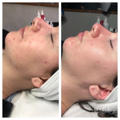 Soins traitants de la peau - Institut de beauté à Grésy sur Aix