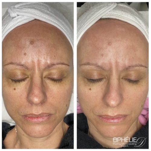 Soins traitants de la peau - Institut de beauté à Grésy sur Aix