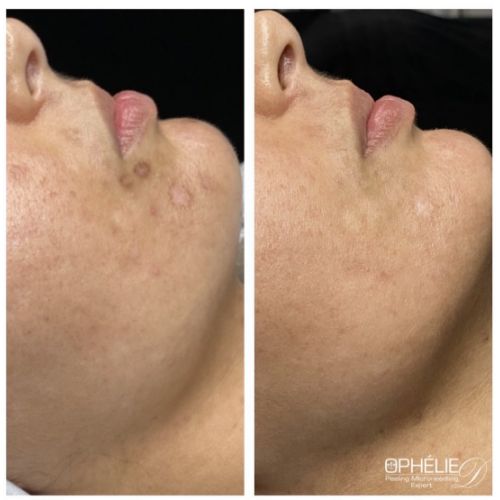 Soins traitants de la peau - Institut de beauté à Grésy sur Aix