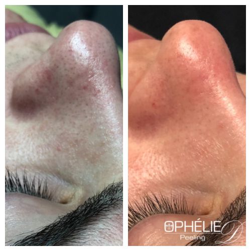 Soins traitants de la peau - Institut de beauté à Grésy sur Aix