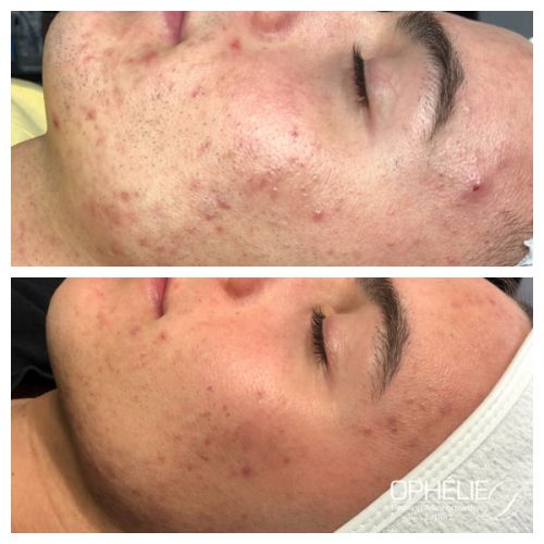 Soins traitants de la peau - Institut de beauté à Grésy sur Aix