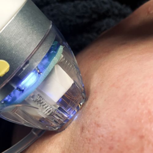 Soins traitants de la peau - Institut de beauté à Grésy sur Aix