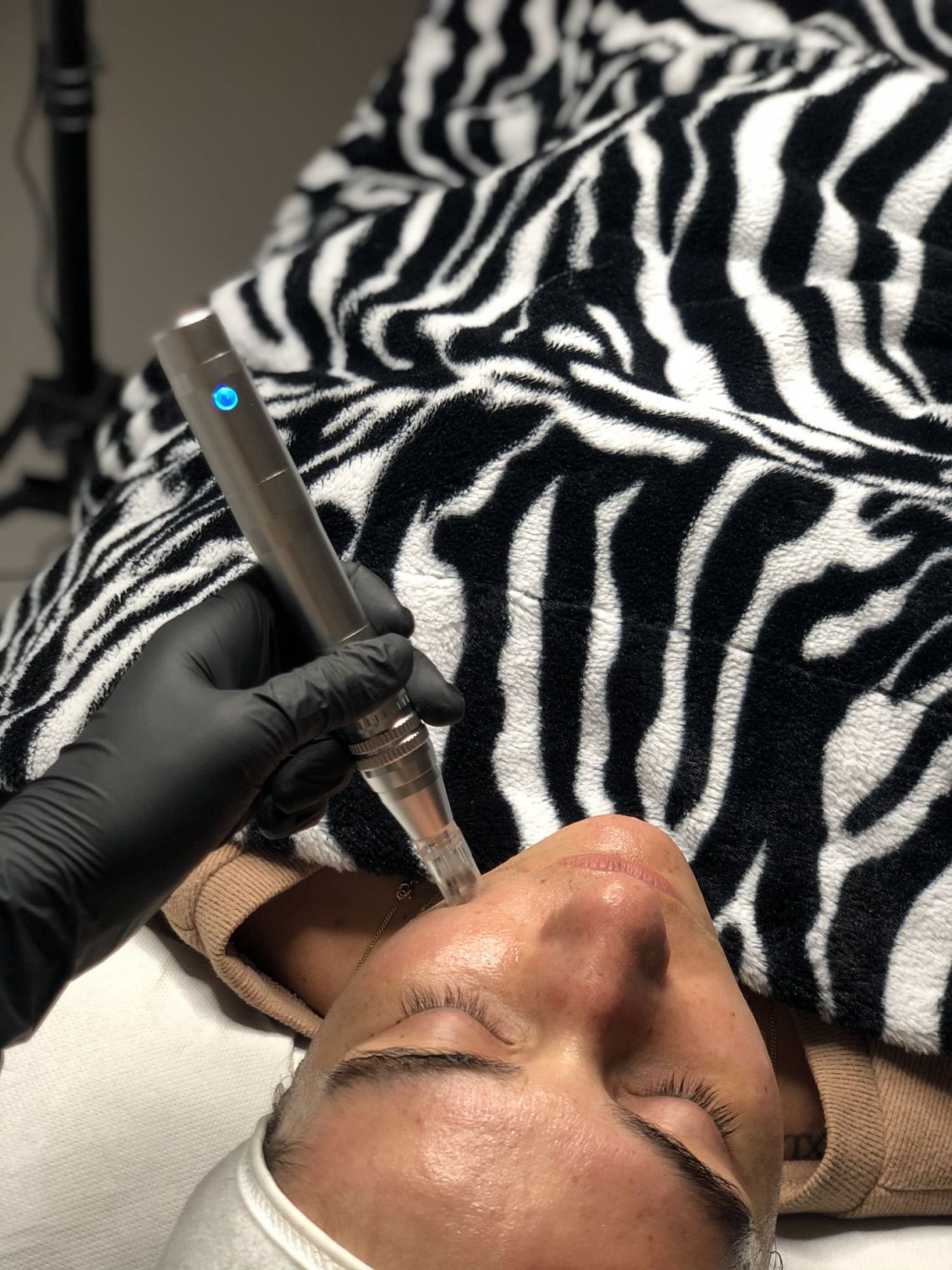 Soins traitants de la peau - Institut de beauté à Grésy sur Aix